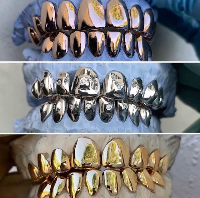 Gleefull Grillz LLC, Gold Grillz & Jewelry | restaurant | 929 McDuff Ave S, Jacksonville, FL 32205, USA | 9549808995 OR +1 954-980-8995
